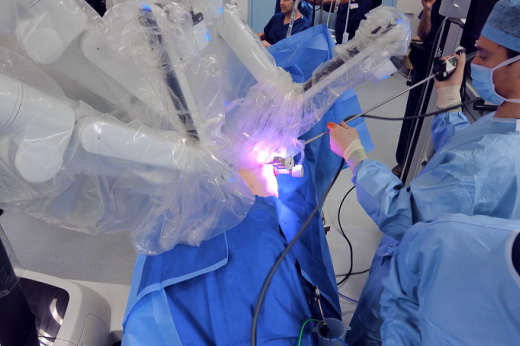 A group of surgeons in masks and scrubs operating on a patient under a blue sheet. They are using white robotic arms of the da Vinci Xi robot.
