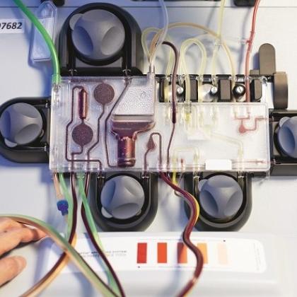 A selection of controls on top of a machine with tubes of blood entering and leaving